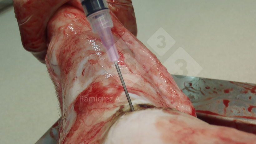 Figura 1. Recogida de muestra de líquido articular en un cerdo muerto. Se elimina la piel y se usa una jeringa para recoger el líquido articular de forma aséptica.
